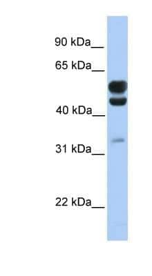 Western Blot: EOGT/AER61 Antibody [NBP1-57931]