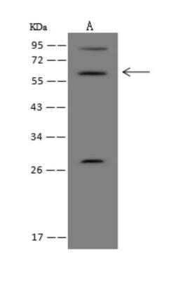 Western Blot: EOGT/AER61 Antibody [NBP3-05987]