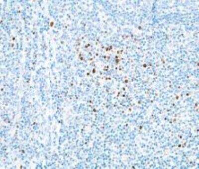 Immunohistochemistry: EOMES Antibody (BLR104H) [NBP3-07014]