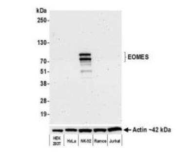 Western Blot: EOMES Antibody (BLR104H) [NBP3-07014]