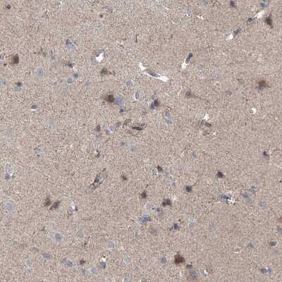 Immunohistochemistry-Paraffin: EOMES Antibody [NBP1-80699]