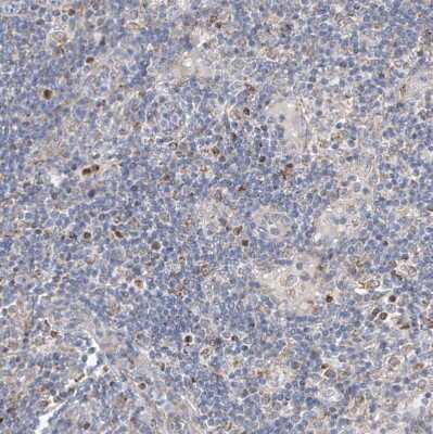 Immunohistochemistry-Paraffin: EOMES Antibody [NBP1-80699]