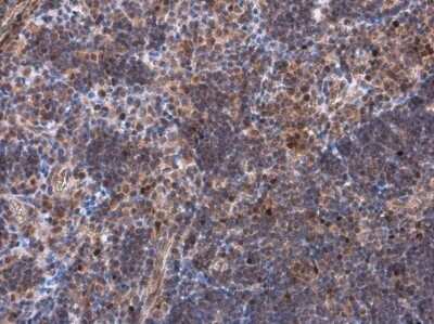 Immunohistochemistry-Paraffin: EOMES Antibody [NBP3-13356]
