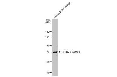 Western Blot: EOMES Antibody [NBP3-13136]