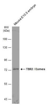 Western Blot: EOMES Antibody [NBP3-13356]