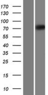 Western Blot: EOMES Overexpression Lysate [NBL1-10285]