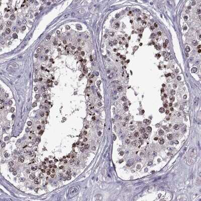Immunohistochemistry-Paraffin: EP400NL Antibody [NBP2-49551]