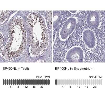 Immunohistochemistry-Paraffin: EP400NL Antibody [NBP2-49551]