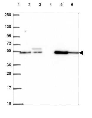 Western Blot: EP400NL Antibody [NBP2-49551]