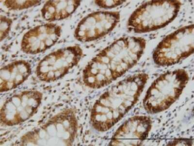 Immunohistochemistry-Paraffin: EPB41 Antibody (3D9) [H00002035-M01]
