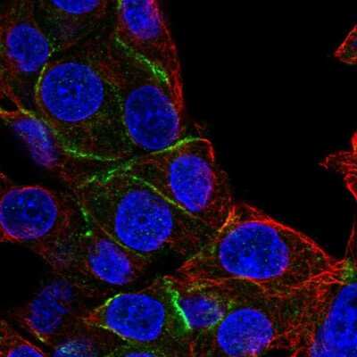 Immunocytochemistry/ Immunofluorescence: EPB41 Antibody [NBP2-58715]