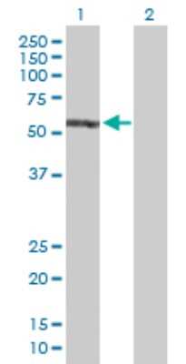 Western Blot: EPB41 Antibody [H00002035-D01P]