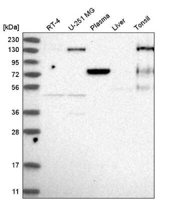 Western Blot: EPB41 Antibody [NBP2-55092]