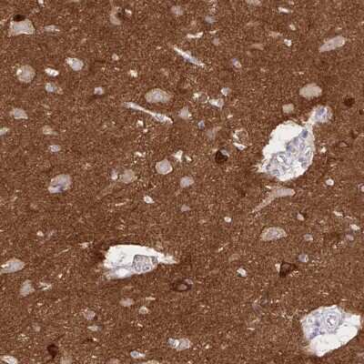 Immunohistochemistry-Paraffin: EPB41L1 Antibody [NBP2-31572]