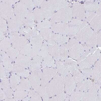 Immunohistochemistry-Paraffin: EPB41L1 Antibody [NBP2-31572]
