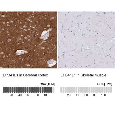 Immunohistochemistry-Paraffin: EPB41L1 Antibody [NBP2-31572]