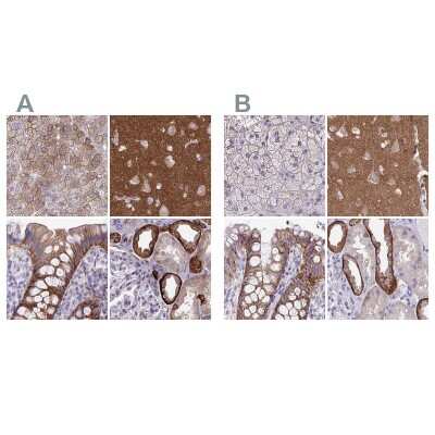 Immunohistochemistry-Paraffin: EPB41L1 Antibody [NBP2-31572]
