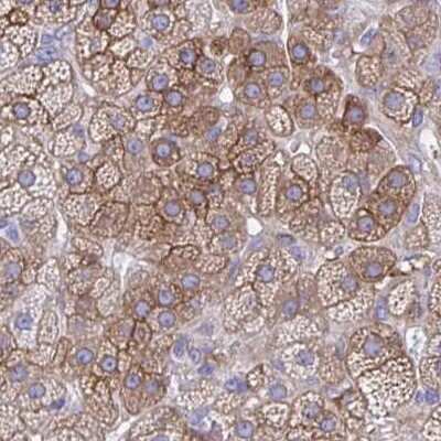 Immunohistochemistry-Paraffin: EPB41L1 Antibody [NBP2-31572]