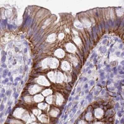 Immunohistochemistry-Paraffin: EPB41L1 Antibody [NBP2-31572]