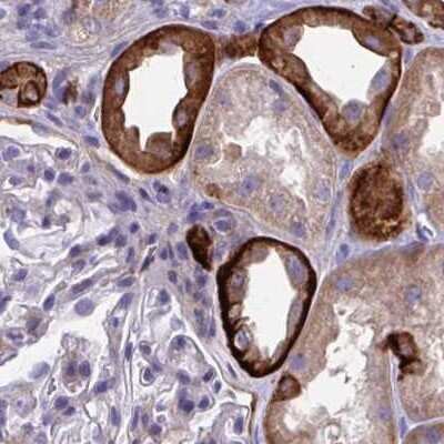 Immunohistochemistry-Paraffin: EPB41L1 Antibody [NBP2-31572]
