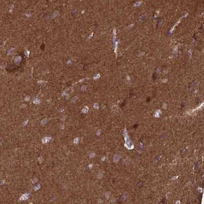 Immunohistochemistry-Paraffin: EPB41L1 Antibody [NBP2-31650]