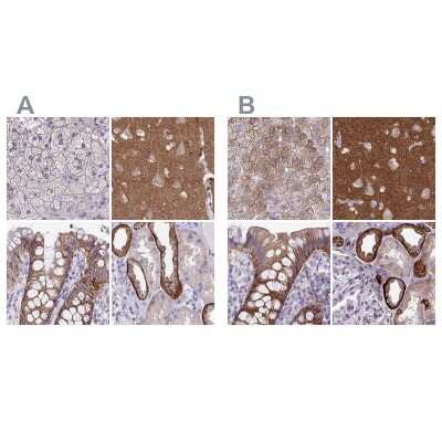 Immunohistochemistry-Paraffin: EPB41L1 Antibody [NBP2-31650]