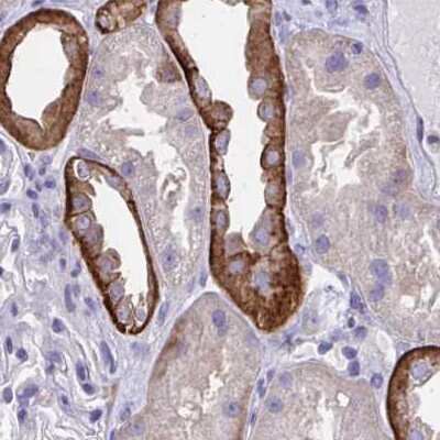 Immunohistochemistry-Paraffin: EPB41L1 Antibody [NBP2-31650]