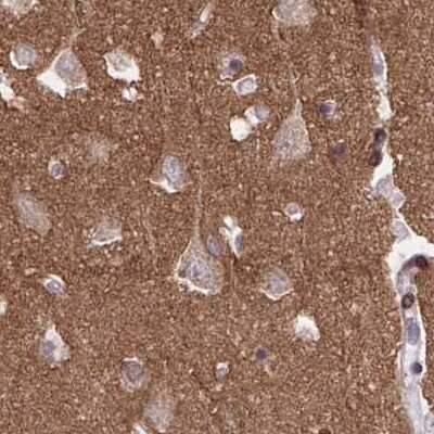 Immunohistochemistry-Paraffin: EPB41L1 Antibody [NBP2-31650]