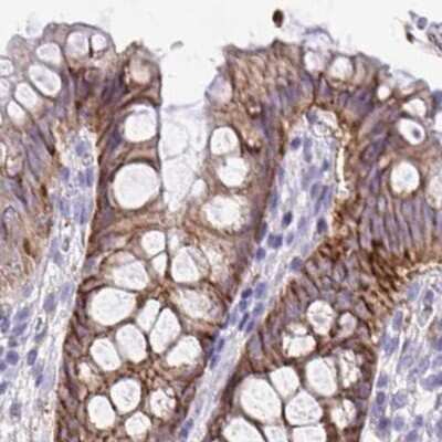 Immunohistochemistry-Paraffin: EPB41L1 Antibody [NBP2-31650]
