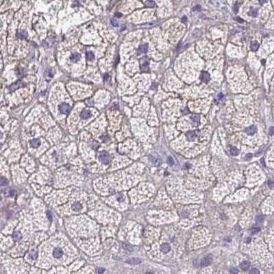 Immunohistochemistry-Paraffin: EPB41L1 Antibody [NBP2-31650]