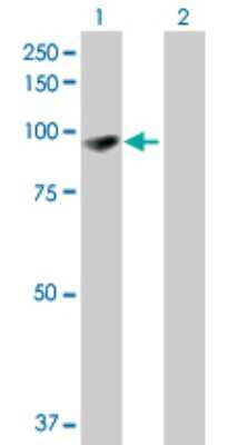 Western Blot: EPB41L1 Antibody [H00002036-B01P]