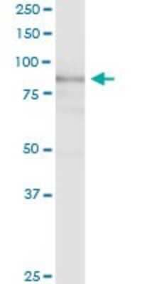 Western Blot: EPB41L1 Antibody [H00002036-D01P]