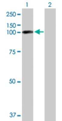 Western Blot: EPB41L1 Antibody [H00002036-D01P]