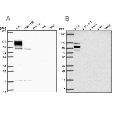 Western Blot: EPB41L1 Antibody [NBP2-31572]