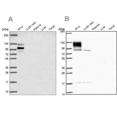 Western Blot: EPB41L1 Antibody [NBP2-31650]