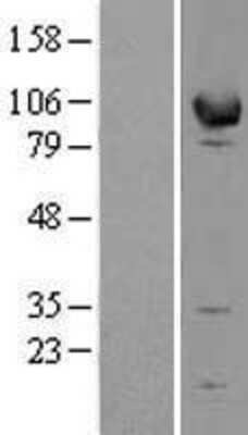 Western Blot: EPB41L1 Overexpression Lysate [NBL1-10287]