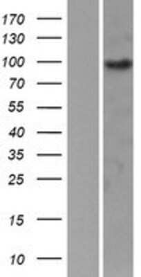 Western Blot: EPB41L1 Overexpression Lysate [NBP2-09845]