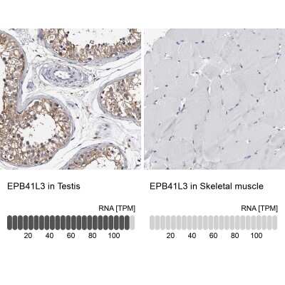 Immunohistochemistry-Paraffin: EPB41L3 Antibody [NBP1-89372]