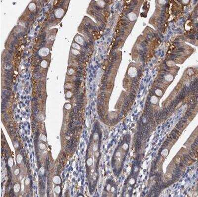 Immunohistochemistry-Paraffin: EPB41L3 Antibody [NBP1-89372]