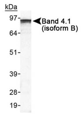 Western Blot: EPB41L3 AntibodyBSA Free [NB110-61027]