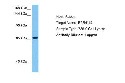 Western Blot: EPB41L3 Antibody [NBP2-84858]