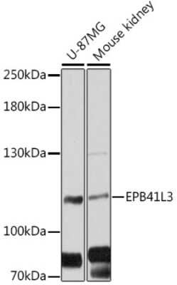 Western Blot: EPB41L3 AntibodyAzide and BSA Free [NBP3-05141]