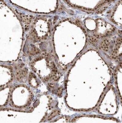 Immunohistochemistry-Paraffin: EPB41L4A Antibody [NBP1-81009]