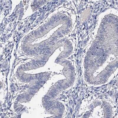 Immunohistochemistry-Paraffin: EPB41L5 Antibody [NBP2-30920]