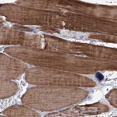 Immunohistochemistry-Paraffin: EPB41L5 Antibody [NBP2-30920]
