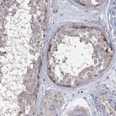 Immunohistochemistry-Paraffin: EPB41L5 Antibody [NBP2-30920]