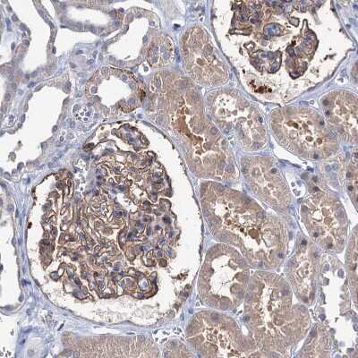 Immunohistochemistry-Paraffin: EPB41L5 Antibody [NBP2-30920]