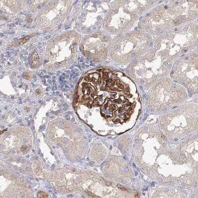 Immunohistochemistry-Paraffin: EPB41L5 Antibody [NBP2-38354]