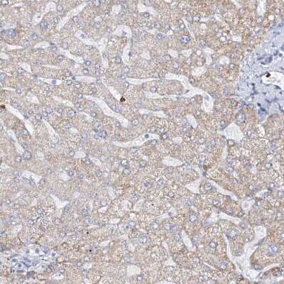 Immunohistochemistry-Paraffin: EPB41L5 Antibody [NBP2-38354]