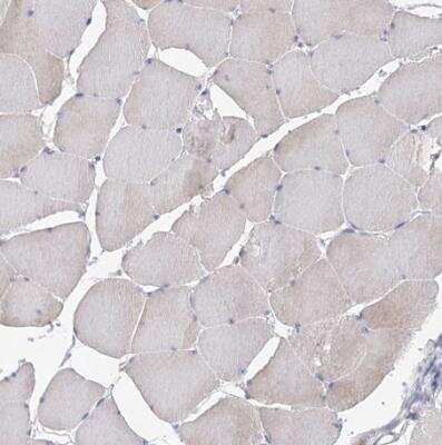 Immunohistochemistry-Paraffin: EPB41L5 Antibody [NBP2-38354]